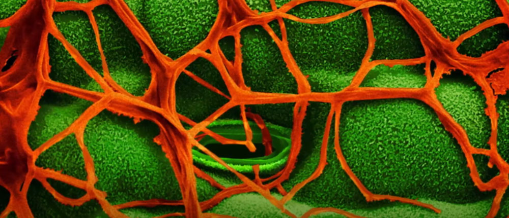 disease pressure BASF